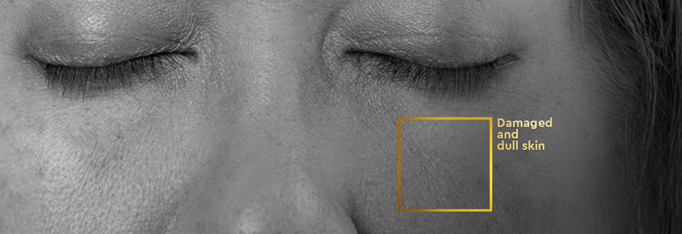 Benefits of 100 g - ProRescue Bio Cream