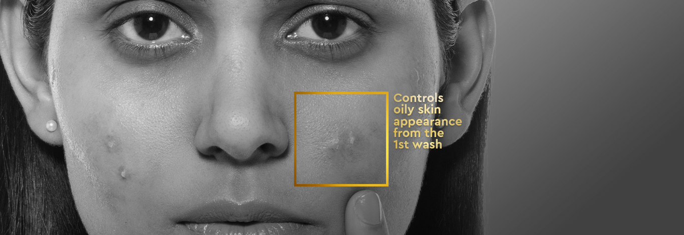 Benefits of Anti Acne Face Wash - 150 ml - With Salicylic Acid & Neem