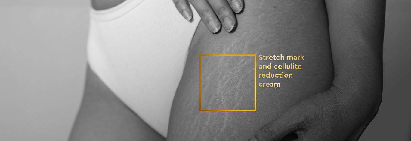 Benefits of Anti Stretch Mark Cream - 100 ml - With Palmitoyl Tripeptide & Crocus Chrysanthus Extract