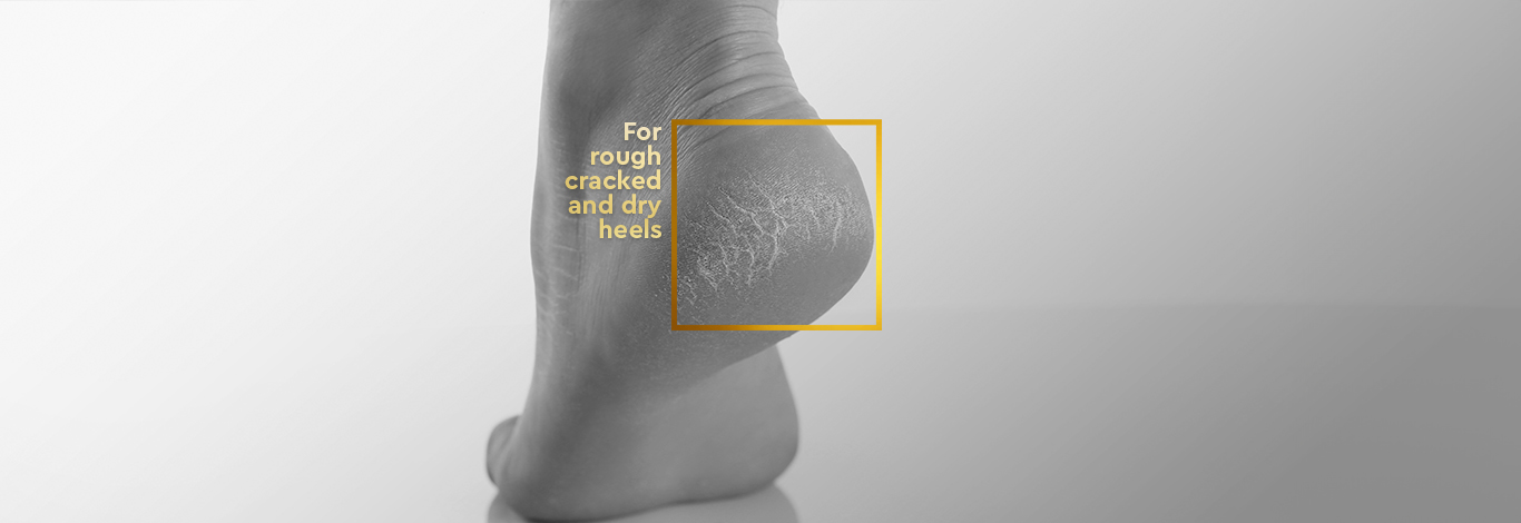 Benefits of Heel Repair Cream - 100 g