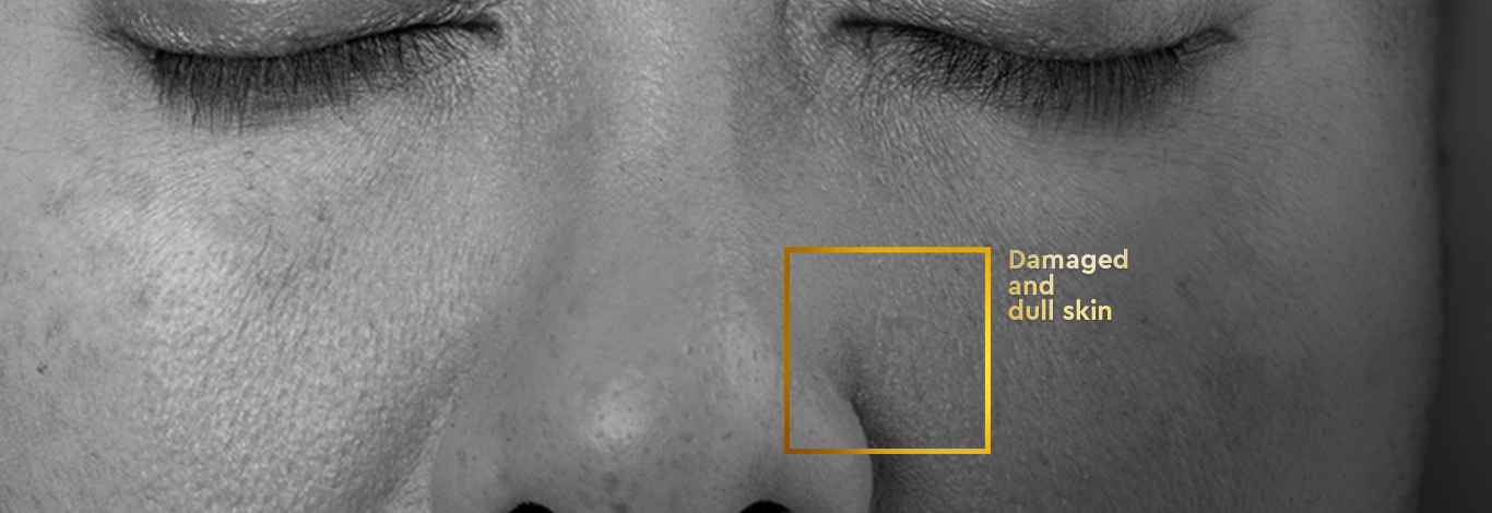 Benefits of 30 ml - ProRescue Micro Serum 