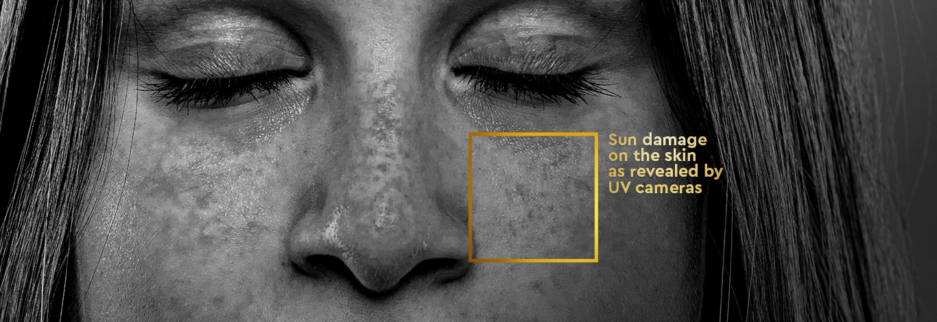 Benefits of ProDefence Anti Tan Sun Screen Lotion - Spf25 -100 g - With Lemon Extract